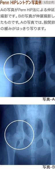 Penn HIP�����g�Q���ʐ^��